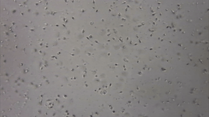 live sperm recording